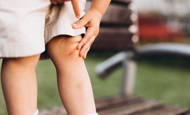 Pengobatan Nyeri Sendi pada Anak-anak